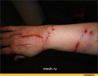 Есть ещё одна сторона этой работы

При этом кусаются и царапаются все- собаки ,кошки ,хорьки ,кролики и морские свинки .