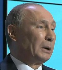 Тоже не лучшая работа хирурга и ботокса ))