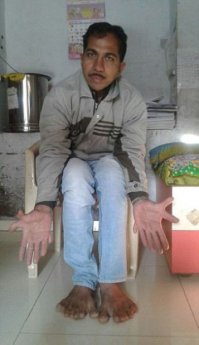 Как он ногу просунул в такую узкую штанину?