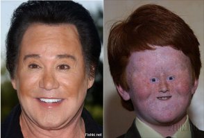 22 знаменитых мужчины, о которых вы не знали, что они делали пластические операции