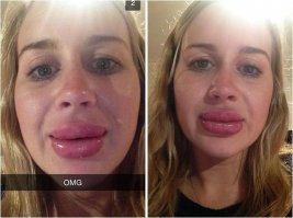 Не повезет, так не везет