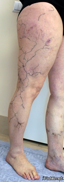 а потом у вас будут вот такие красивые ноги