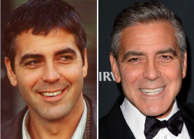 Джордж Клуни и с первыми зубами красавец!))