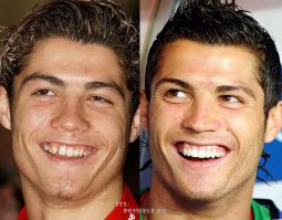 пластика? не слышал...