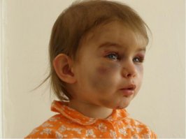 Мать избила восьмилетнего сына железной трубой