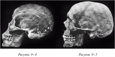 Немного поумничаю.
Если восстановить профиль сфинкса, то получится явный представитель африканской расы, у них прогнатизм (выступающая нижняя челюсть - фото слева) развита сильнее, чем у европеоидов (на фото справа).
Так что, вопрос "кто такой сфинкс" считаю закрытым..
