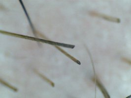 Срез волоса бороды.
Экран мобильного.
Край лезвия ножа.
Кристалл сахара.
Снято на эту лабуду