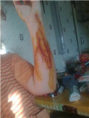 Попа из ожидания - просто вах!

А с котами бывает гораздо "веселее", палец у меня до конца не сгибается.