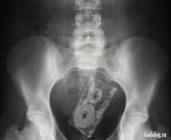 подручными- опасно!