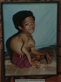 а от мутаций вызванных "агентом оранж" вьетнамцы уже отказались?