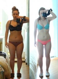 Были ноги полные и стройные, стали худые и кривые.