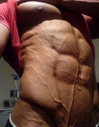 Врач производное от слова - врать. там варикозом и не пахнет. При гипертрофировании (увеличении) мышц, вену выталкиваются наружу, под кожу. Узри разницу.