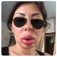 И сейчас не лучше травятся