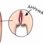 Подумал свеч горящая......