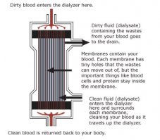Можно, с воздействием диализата. Вот на этой картинке объяснение "магии" диализа. Извиняйте, на русском не смог найти. Краткий перевод: "грязная" кровь заходит в мембраны фильтра сверху, очищенная выходит снизу, из тех же мембран. Против течения крови пускается диализат, через стенки мембран он вытягивает всякую хрень из крови.