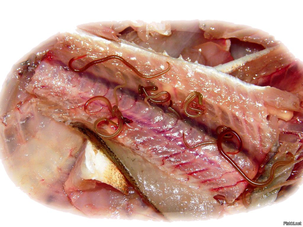 Описторхоз в рыбе: как избежать заражения.
При проведении полного цикла засолки рыбы готовый продукт может считаться безопасным. Если вес рыбы не превышает 10–15 г и вся рыба густо пересыпана солью, то личинки двуустки полностью погибают на 3–4 сутки, если вес рыбы превышает один килограмм, то гибель паразитов происходит через 10 суток.
В процессе холодного копчения нет никакой гарантии относительно безопасности продукта, тем не менее от возбудителей заболевания можно избавиться, посолив предварительно рыбу в крепком рассоле. Метацеркарии паразитов проявляют устойчивость к низким температурам: так, при –2 °С личинки в мелкой рыбе гибнут только на четвертые-пятые сутки, крупная рыба считается безопасной для дальнейшего использования только после двух-трех недель воздействия низких температур. При температуре –23–25 °С личинки погибают спустя 72 часа; если температура заморозки ниже –30 °С, то для полного уничтожения личинок возбудителя понадобится не менее шести часов. В рыбе, замороженной при температуре ниже –40 °С, личинки гибнут спустя 3 часа. Опасной с точки зрения инфицирования считается свежая «строганина». При приготовлении этого блюда личинки описторхоза в рыбе остаются, так как её замораживание происходит недостаточно глубоко.
