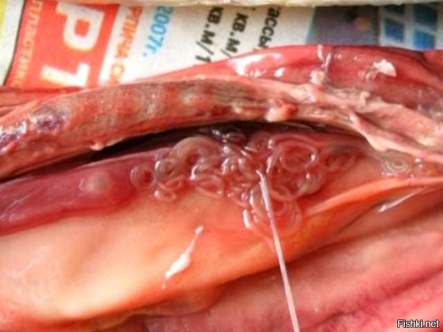 Описторхоз в рыбе: как избежать заражения.
При проведении полного цикла засолки рыбы готовый продукт может считаться безопасным. Если вес рыбы не превышает 10–15 г и вся рыба густо пересыпана солью, то личинки двуустки полностью погибают на 3–4 сутки, если вес рыбы превышает один килограмм, то гибель паразитов происходит через 10 суток.
В процессе холодного копчения нет никакой гарантии относительно безопасности продукта, тем не менее от возбудителей заболевания можно избавиться, посолив предварительно рыбу в крепком рассоле. Метацеркарии паразитов проявляют устойчивость к низким температурам: так, при –2 °С личинки в мелкой рыбе гибнут только на четвертые-пятые сутки, крупная рыба считается безопасной для дальнейшего использования только после двух-трех недель воздействия низких температур. При температуре –23–25 °С личинки погибают спустя 72 часа; если температура заморозки ниже –30 °С, то для полного уничтожения личинок возбудителя понадобится не менее шести часов. В рыбе, замороженной при температуре ниже –40 °С, личинки гибнут спустя 3 часа. Опасной с точки зрения инфицирования считается свежая «строганина». При приготовлении этого блюда личинки описторхоза в рыбе остаются, так как её замораживание происходит недостаточно глубоко.
