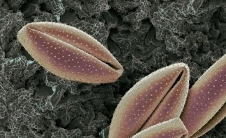 пыльца под микроскопом