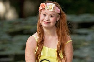 С синдромом дауна в моделях тоже есть