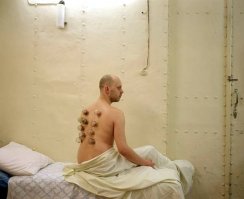 Трусы-то зачем снял ?  Банки на жопу не ставили . 
Или уже тогда готовился стать европейцем ?