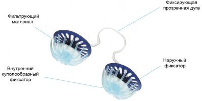 я еще такие штуки использую в нос на улице, ношу правда не очень долго, потому еще не совсем ясно помогает ли))