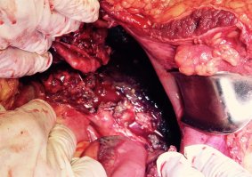 любителям ягуаров и пр. коктельчиков- привет от панкреонекроза