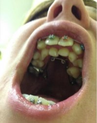 До 50-ти?
Ну...Бонжур, епта...