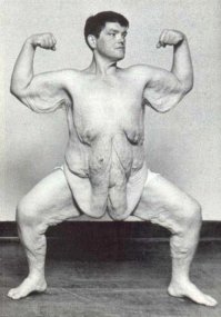 50+ впечатляющих примеров невероятного похудения	