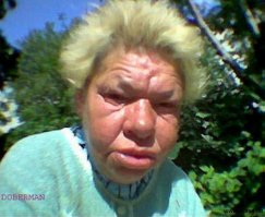 Точно,все от пластических операций...