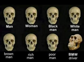 БМВ головного мозга