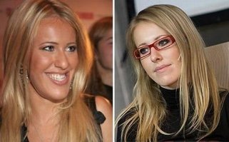 Да ну нафиг! Это реально у нее такая морда была? Это не фотошоп? После конечно стало получше гораздо!