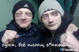 Пользователи Твиттера прикалываются над фото девушки, которой в глаза попал ядовитый плющ