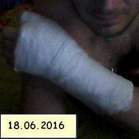 ...традиция у меня такая:каждый год,во второй декаде июня ломать себе большие пальцы по ул.Ленина при езде на велосипеде!!!