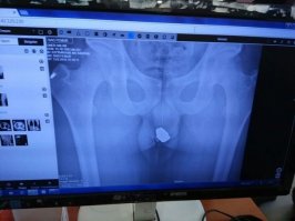 судя по очку его перед снимком изрядно наказали