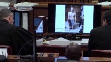 Это ты дебил. И там и там протезы. На первой фотке они заляпаны кровью. Можешь почитать на оригинале.