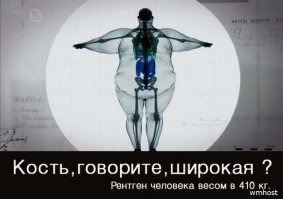 Самый толстый мальчик в мире: 192 кг в 10-летнем возрасте