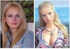 а вон ниже до и после нашли фотки! С копипастю с разрешения... ;)