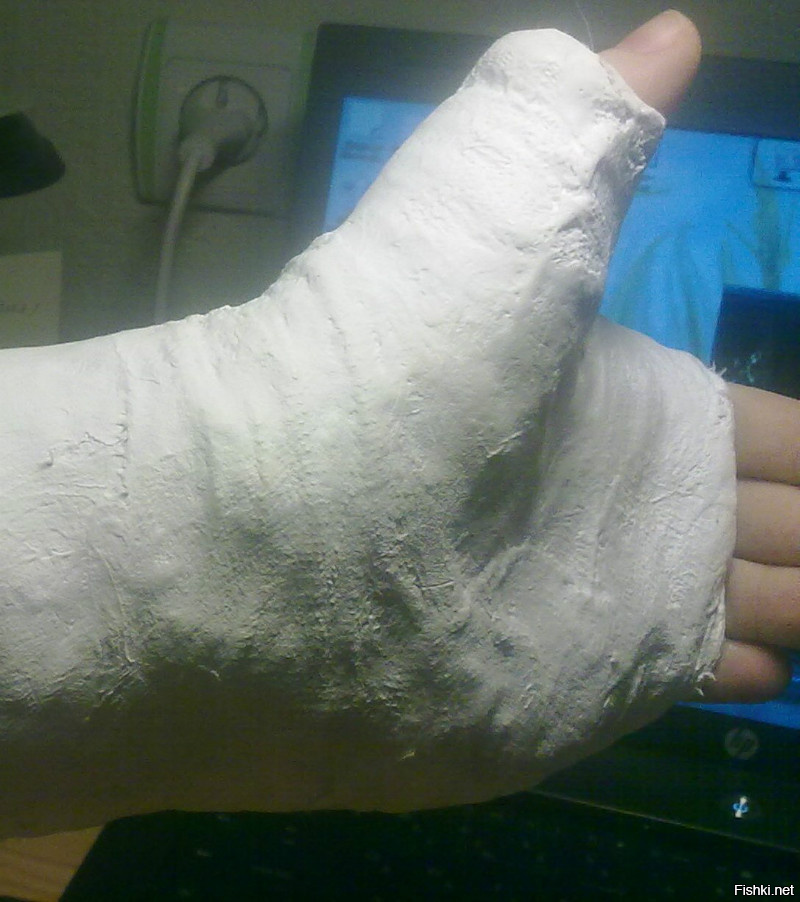 у меня сын 10 лет в регби играет, как-то на игре кисть левой руки сломал, но до конца игры никому не сказал, тренеру сказал что просто ушиб, но играть может и только после срочно его повезли в травмпункт. он всё-равно был счастлив что заняли первое место.
вот это мужик, слезы идут, боль дикая, но играет без нытья
ещё фотография с той игры сохранилась