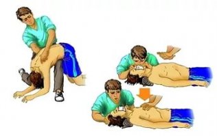 Главное в похожей ситуации не теряться и помнить, что при утоплении есть около 5 минут для реанимации и возвращении к жизни утонувшего без последствий для его головного мозга.
Лето в разгаре. Купальный сезон тоже. Возможно эта картинка поможет спасти чью-то жизнь: