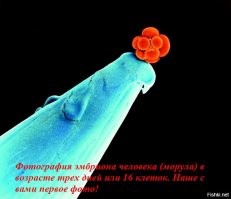 Этот удивительный микромир!