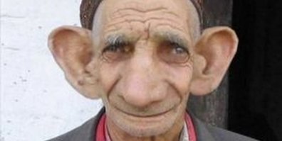 Житель украинской деревни Сергей Мальченко имеет самые большие уши в мире, но слышит ими он плохо.