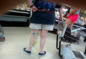 вот тут я бы не стал смеяться, скорее всего это нефростома (может уретральный катетер), а это жизненно-важная необходимость и совсем не смешная.