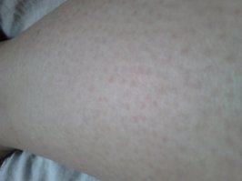 да пожалуйста. я конечно понимаю что в дальнейшем все равно будут придирки к кач-ву фото и к порам на ногах и прочее, чем согласится кто то, что "маловолосяные" есть женщины. Моя голень