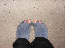 если только такие, газовой атакой