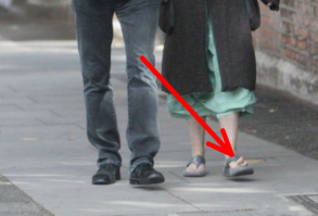 А что у неё с пальцами на ноге?