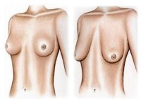 угадай, где цветы