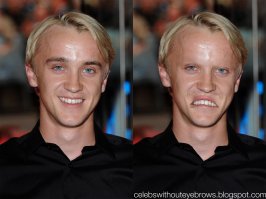 Легкий испуг: знаменитости без бровей