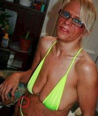 чиРРРРяк,ПРЫщЬ,ФУРУНКУЛ