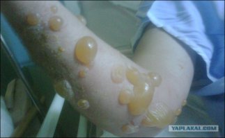 Держись от "зонтика" подальше