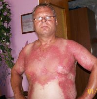 Держись от "зонтика" подальше